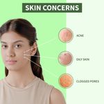 Buy DermDoc 2% Salicylic Acid Anti Acne Face Gel ( 50 g) | salicylic acid moisturizer | salicylic acid gel | acne cream | acne treatment | anti acne gel | moisturizer for oily skin | mosturizer for oily skin - Purplle