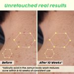 Buy PLIX Jamun 2% Salicylic Acid Body Wash For Body Acne | Paraben & Silicones Free | Deeply Exfoliating | Prevents Back Acne, Exfoliates Dead Skin Cells & Moisturizes Skin | 236ml - Purplle