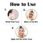 Buy Vigini 35% Actives Acne Pit Scars Spot Stop Face Day Night Gel Oily Prone Skin Pimples Remover Reduce Redness Pores Tightening Niacinamide Tea Tree Oil (Salicylic Glycolic Hyalurnoic) Acid Neem Ext SPF 30 Men Women 20ml - Purplle