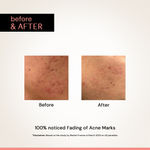 Buy Deconstruct Niacinamide Face Serum | Fades Dark Spots, Pigmentation & Tanning - 30 ml - Purplle