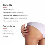 Buy DERMATOUCH Bye Bye Stretch Marks Cream | For Pregnancy to Reduce Stretch Marks & Scars | With Shea Butter & Cocoa Butter | 70G - Purplle