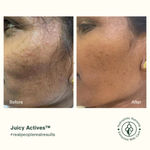 Buy Juicy Chemistry Well Ageing Kit Combo of 4 - Purplle