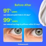 Buy Chemist At Play Under Eye Cream withA 2.5%A A Quinoa Ceramides + Green Tea +Popstbiotics+ caffeineA Extract | For Dark Circles, Puffiness, Wrinkles, Crows Feet | Lightweight, Hydrating | Plant-based Ceramides, 100% Vegan | 15 gm - Purplle