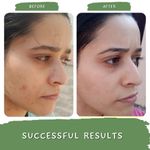 Buy Mystiq Living Green Coffee Blemish Clear Face Pack (100 GM) Tan Removal, Face Mask, Anti Pigmentation, Dark Spot Removal, De Tan and Glowing Skin|D Tan Pack Ayurvedic Formulation, For Women & Men 100 gm - Purplle