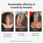 Buy Arata Intensive Hair Growth Serum With 5% Kopexil+3% Redensyl+3% Procapil - 30 ml - Purplle
