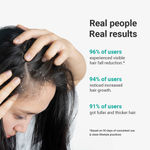 Buy Arata Intensive Hair Growth Serum With 5% Kopexil+3% Redensyl+3% Procapil - 30 ml - Purplle