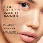 Buy Lakme Peach Ceramide Moisturizer with SPF 24| For Dry Skin, Normal Skin & Sensitive Skin 120 ml - Purplle