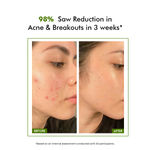 Buy Conscious Chemist Flashfix Acne Treatment Serum | 2% Salicylic Acid & 0.5% Zinc PCA - 30 ml - Purplle