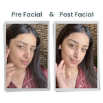 Buy Alps Goodness Diamond Hydrating Facial Kit with Glycerine (34 gm) | Glowing Skin | Toning & Firming |Detoxification |At home Facial - Purplle