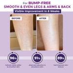 Buy Sanfe Bumps Erasing Body Scrub for Rough & Bumpy Skin, Tan and Strawberry Legs | Glycolic Acid, Walnut Shell | Bath to Remove Dirt, Dead Skin | 100g for women for soft & bright skin - Purplle