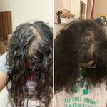 Buy Curl Cure Hair Growth Elixir - Purplle