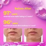 Buy Chemist at Play Acne Control Face Wash with Ceramides |  2% Salicylic Acid +Azelaic acid Cica  | For oily, acne-prone skin | Eliminates invisible pimples and blackheads | 100 ml - Purplle