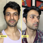 Buy PLIX Pineapple De-pigmentation Juicy Facewash with Niacinamide 100 ml - Purplle