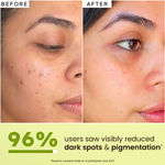 Buy Hyphen Golden Hour Glow Face Serum With Niacinamide, Alpha Arbutin, Hyaluronic Acid & Kakadu Plum | For Glowing Skin & Hydration - 30 ml - Purplle