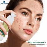 Buy Riyo Herbs Acne Spot Treatment Gel -30 ml - Purplle