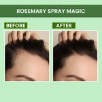 Buy Alps Goodness Rosemary Revive Kit I Rosemary Water Spray+Rosemary Essential Oil+Scalp Massager I Hair Growth Expert I For Skin & Hair I Improves Scalp Health I Fights Acne - Purplle