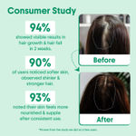 Buy Aravi Organic Rosemary Lavender Hair Oil for Healthy Scalp & Hair Roots | 100% Pure & Natural | Promotes Hair Growth & Controls Hair Fall | Nourishing & Lightweight | For Men & Women – 200 ml - Purplle