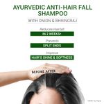 Buy Sesa Ayurvedic Anti-Hair Fall Shampoo - Bhringraj, Onion & 17 Ayurvedic Herbs - Control Hair Fall in 2 Weeks 500ml - Purplle