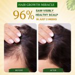 Buy Mystiq Living Rosemary Water for Hair Growth, Mist Spray Steam Distilled 100% Pure and Natural Hydrosol, Hair Mist - 100 ml - Purplle