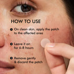Buy MCaffeine Matcha Tea Hydrocolloid Acne Patches 24 patches - Purplle