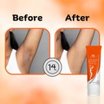 Buy Intimify Underarm Whitening Cream 50 gm - Purplle