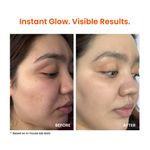 Buy Foxtale Super Glow Moisturiser |  Vitamin C +Niacinamide +Squalane 50 ml - Purplle