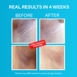 Buy Carmesi x DERMDOC Combo Kit for No-Fuss Grooming (Carmesi Bikini Razor for Women + DERMDOC by Purplle 5% Glycolic Acid Under Arm Treatment (100 ml) ) - Purplle