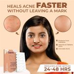 Buy Sanfe Promise Face Acne Patch - Pack of 36 | Pimple Healing Patch | Absorbing Cover |Invisible, Blemish Spot, Hydrocolloid, Skin Treatment - Purplle