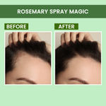 Buy Alps Goodness Rosemary Hair Growth Duo | With Rosemary Hair Spray (100 ml) & Rosemary Essential Oil (10 ml) I For Skin & Hair I Improves Scalp Health I Fights Acne - Purplle