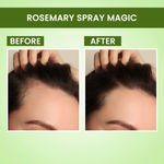 Buy Alps Goodness Hair Growth Expert Kit (Pack of 2) with Rosemary Water Spray (100 ml) & Rosemary Water Refill (305 ml) | Hair Regrowth | Viral Rinse | Mess Free Spray - Purplle
