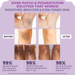 Buy Sanfe Instant Spotlite Mask | Lightens Dark Patches in 10 Minutes | Exfoliates Dirt & Dead Skin in Minutes | Instant Results Guaranteed| 100 gm - Purplle