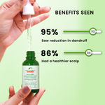 Buy Alps Goodness Aloe Vera, Hyaluronic Acid & Ketoconazole Anti Dandruff Scalp Serum For Dry Scalp (30 ml) - Purplle