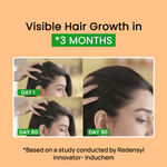 Buy Alps Goodness Anti Hairfall Scalp Serum with Fenugreek Biotin and Redensyl (30 ml) | Methi Hair Serum | Silicone & Sulphate Free | Hairgrowth Serum For All Hair Types - Purplle