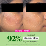 Buy Dot & Key CICA Sun Protect & Oil Control Duo - 100 gm | Face Sunscreen & Face Cream - Purplle