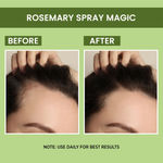 Buy NY Bae X Alps Goodness | Matte Setting Spray | Rosemary Water For Hair | Hair Regrowth | Hydrating Face Mist | Green Tea | Glowing Skin - Makeup Kits Combo of 2 - Purplle