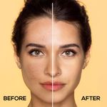 Buy RENEE 15% Vitamin C, 1% Salicylic & 2% Niacinamide Face Serum for Glowing Skin, Reduces Dark Spots, Acne, Fine Lines & Wrinkles, Smoothens, Brightens & Evens Out, for All Skin Type - 30 ml - Purplle