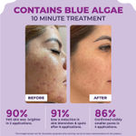 Buy Sanfe 25% AHA + 2% BHA Peeling Solution For Face & Body | Exfoliates, De-tan & Removes Ingrown Hairs | 10min Treatment, 30 ml - Purplle