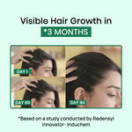 Buy Alps Goodness Rapid Hair Growth Set with Anti Hairfall Serum with Fenugreek Biotin & Redensyl (65 ml) & Scalp Massager - Purplle