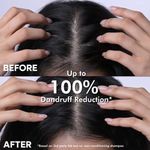Buy Naturali Dandruff Defence Shampoo with Tea Tree Oil & Cactus Extracts | Prevents Dandruff | Paraben and Sulphate Free Shampoo | Anti Dandruff Shampoo | 200ml - Purplle