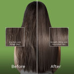 Buy Pilgrim Australian Tea Tree, Anti-Dandruff Scalp Serum (100 ml), Pre-Shampoo Treatment, Helps Balance Scalp Microbiome, Reduces Itchiness & Reduces inflammation - Purplle