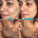 Buy Pilgrim 15% vitamin c face serum for advanced brightness (20 ml) - Purplle