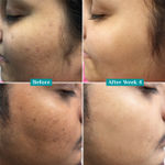 Buy Pilgrim 10% Vitamin C Face Serum For Daily Brightness (30 Ml) - Purplle