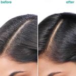 Buy BIOLAGE Scalppure Shampoo + Scalppure Serum (200 ml + 100 ml) - Purplle