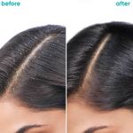 Buy Biolage Professional Scalppure Anti-Dandruff Shampoo, Conditioner & Hair Serum, Removes Visible Flakes, With Bergamot, Vegan, 200 ml + 98 gm + 100 ml - Purplle