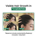 Buy Alps Goodness Scalp Re-invent Kit (Pack of 2) with Anti-hairfall scalp serum (65 ml) & Neem wood comb | 100% Natural Wood | Visible Hair Growth | Scalp Health Care | Thick-Long Hair - Purplle
