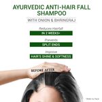 Buy SESA Ayurvedic Anti Hairfall Shampoo For Dry And Frizzy Hair Reduces Hairfall Made With 6 Ayurvedic Herbs Paraben Free Shampoo - 500 ml with Free Serum - Purplle