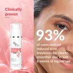 Buy Fixderma 2% Salicylic Acid Acne Defence Face Serum 5% Azelaic Acid & 4% Mandelic Acid | For Men & Women Face Serum For Oily Skin- 30 gm - Purplle