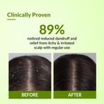 Buy Fixderma Kairfoll Anti Dandruff Shampoo for Oily Sensitive Scalp Prone to Dandruff & Folliculitis | Anti Dandruff Shampoo for Women & Men | Salicylic Acid for Hair Fall | Sulphate Free Shampoo - 100 ml - Purplle