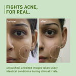 Buy Plum Green Tea Pore Cleansing Face Wash For Oily Skin | With Glycolic Acid | Fights Acne, Controls Excess Oil | Removes Dead Skin Cells | Gentle & Non-Drying | Women & Men | 100% Vegan | 150 ml - Purplle