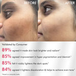 Buy mCaffeine CLEAR GLOW 2% Alpha Arbutin Kojic Acid Brightening Serum Pads with 3% Niacinamide For Dark Spots & Pigmentation | Toner Pads for Even Skin Tone|For Men & Women | Fragrance Free- 40 N (x1) - Purplle
